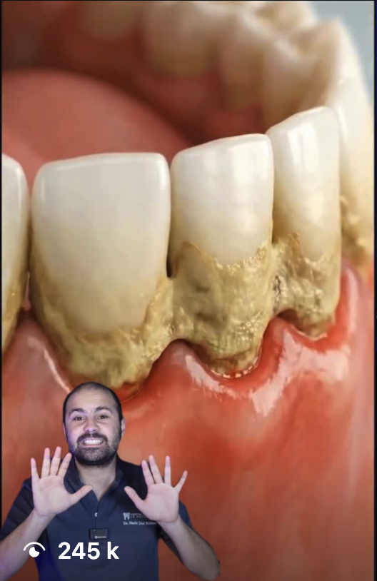 Vidéo virale du Dr Jalal — 245 k vues