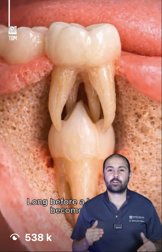 Vidéo virale du Dr Jalal — 538 k vues