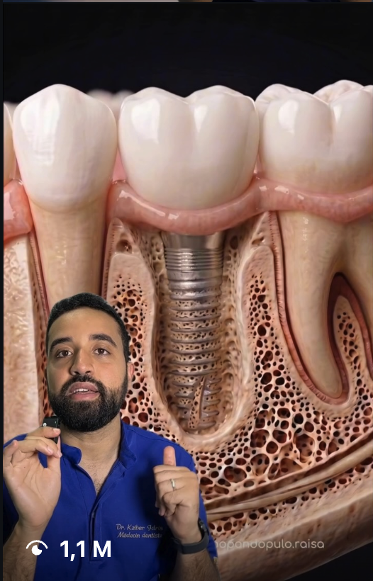 Vidéo virale du Dr Kziber — 1,1 M de vues